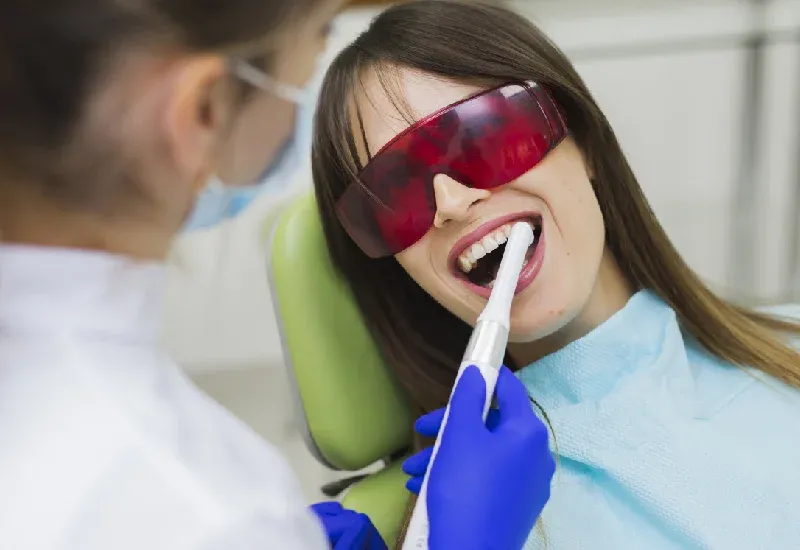 10 Benefit of Professional Teeth Whitening You Should Know