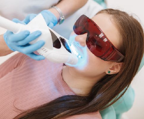 7 Reasons Teeth Whitening Is Most Popular Cosmetic Treatment