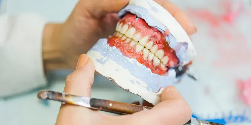 How Dentures Are Made: The Step-by-Step Process Explained