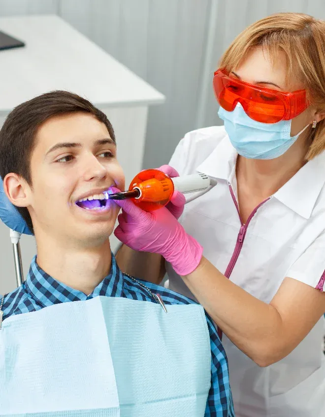 10 Benefit of Professional Teeth Whitening You Should Know