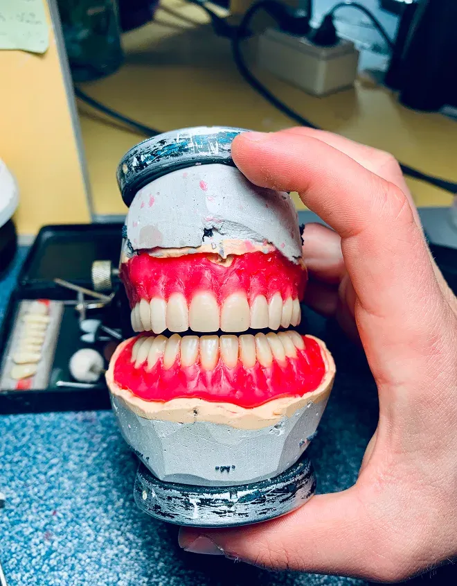 Understanding Dentures: Types, Benefits, and What to Expect